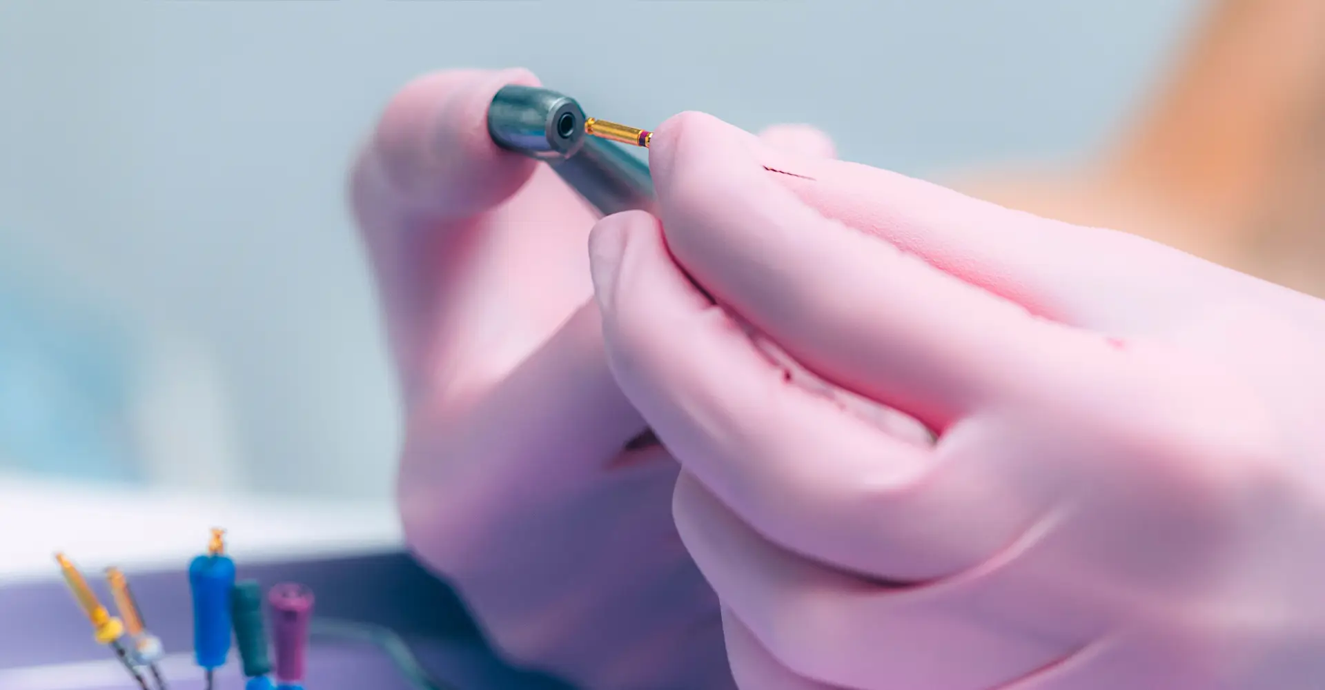 Endodonzia e conservativa