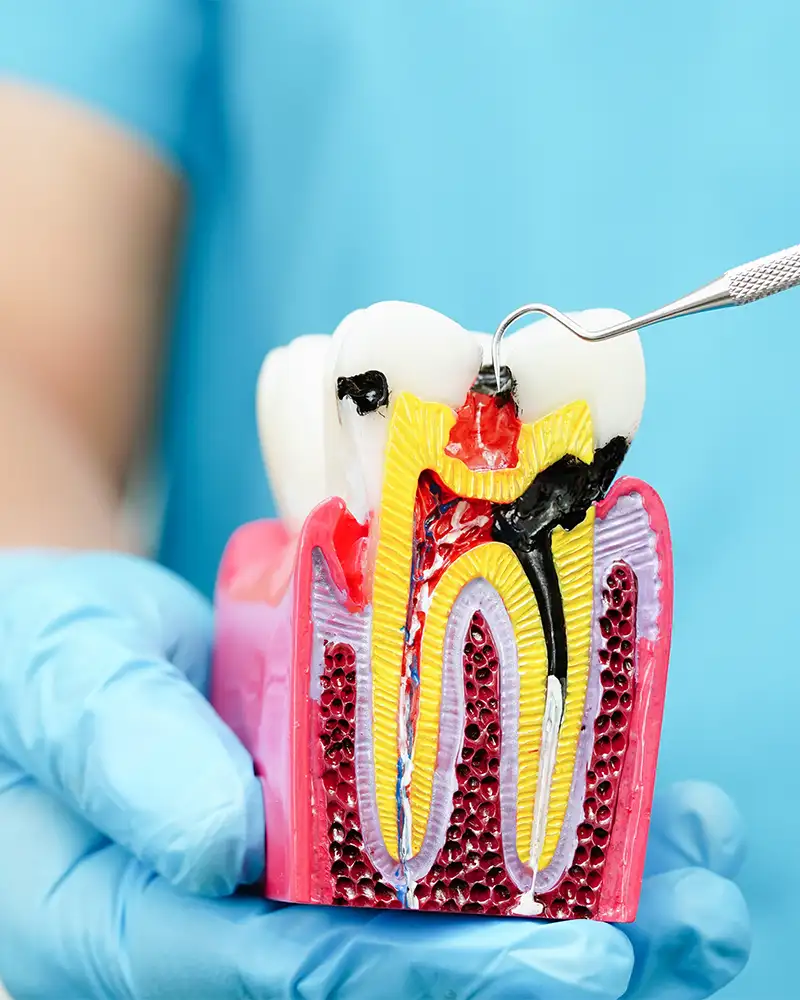 Endodonzia e conservativa