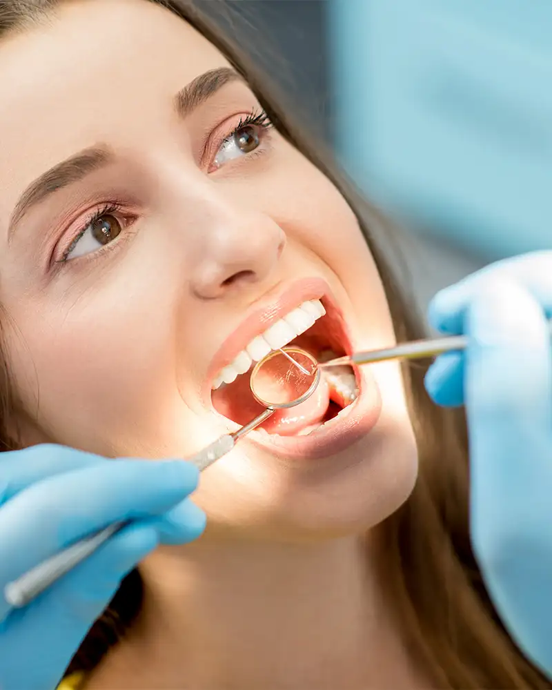 Igiene e sbiancamento